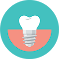 Les Implants dentaires